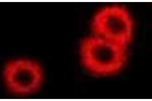 Immunofluorescent analysis of PSAT1 staining in U2OS cells. (PSAT1 抗体)