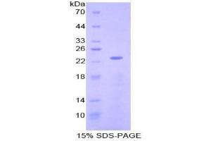 SDS-PAGE analysis of Mouse NME3 Protein. (NME3 蛋白)