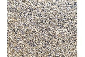 IHC analysis of ATG9A using anti-ATG9A antibody (ABIN7600676). (ATG9A 抗体  (AA 22-169))