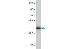 Western Blot detection against Immunogen (36. (NADSYN1 抗体  (AA 609-706))
