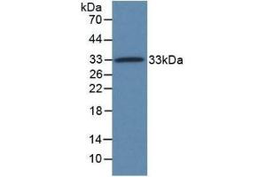 Taxilin alpha (TXLNA) (AA 328-531) (Active) protein (His tag)