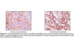 Image no. 1 for anti-Synuclein, gamma (Breast Cancer-Specific Protein 1) (SNCG) antibody (ABIN207620) (SNCG 抗体)