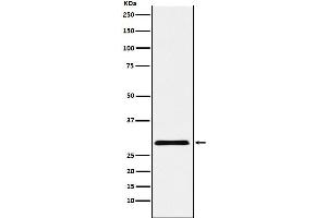 Western blot analysis of cbx7 expression in HepG2 cell lysate.