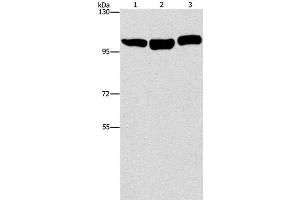 Western Blot analysis of Hela, NIH/3T3 and Raji cell using DNM2 Polyclonal Antibody at dilution of 1:400 (DNM2 抗体)