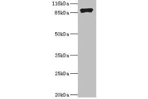 Western blot All lanes: RRM1 antibody at 2 μg/mL + Hela whole cell lysate Secondary Goat polyclonal to rabbit IgG at 1/10000 dilution Predicted band size: 91 kDa Observed band size: 91 kDa (RRM1 抗体  (AA 1-792))