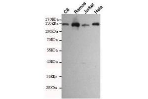 Western blot testing of rat C6 and human Ramos, Jurkat and HeLa cell lysates using JAK1 antibody at 1:1000. (JAK1 抗体)