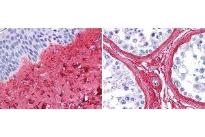Immunohistochemistry (IHC) image for anti-Collagen, Type III, alpha 1 (COL3A1) antibody (ABIN5596829)