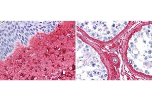 anti collagen III antibody (600-401-105 Lot 26016, 1:400, 45 min RT) showed strong staining in FFPE sections of human skin(left, dermis) with moderate to strong red staining and testis (right) where strong staining was observed within connective tissue between seminiferous tubules.