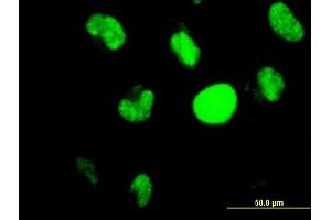 Immunofluorescence of monoclonal antibody to HIC1 on HeLa cell.