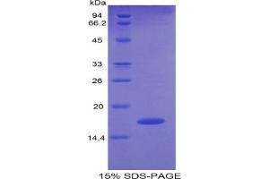 SDS-PAGE of Protein Standard from the Kit (Highly purified E. (Pleiotrophin ELISA 试剂盒)