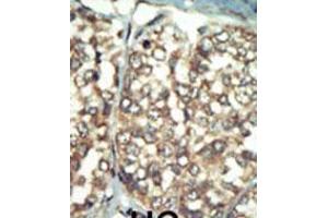 Immunohistochemistry (IHC) image for anti-Phosphatidylinositol 4-Kinase Type 2 beta (PI4K2B) (AA 305-336), (C-Term) antibody (ABIN5532966)