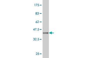 Western Blot detection against Immunogen (36. (CA7 抗体  (AA 34-125))