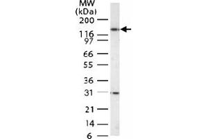 Western blot analysis of HDAC-4 in Jurkat cell lysate with HDAC4 polyclonal antibody  . (HDAC4 抗体  (AA 194-209))
