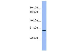 WB Suggested Anti-PENK Antibody Titration: 0. (Enkephalin 抗体  (Middle Region))