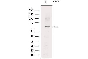 Western blot analysis of extracts from Hela cells, using PKM2(phospho-Ser37) Antibody.