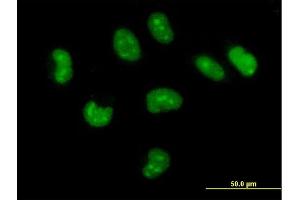 Immunofluorescence of purified MaxPab antibody to CUTC on HeLa cell. (CUTC 抗体  (AA 1-273))