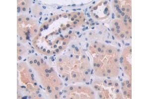 Used in DAB staining on fromalin fixed paraffin- embedded kidney tissue (BCAT2 抗体  (AA 107-392))
