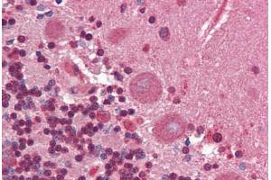 Human Brain, Cerebellum (formalin-fixed, paraffin-embedded) stained with Collagen I antibody ABIN462339 followed by biotinylated goat anti-rabbit IgG secondary antibody ABIN481713, alkaline phosphatase-streptavidin and chromogen. (Collagen Type I 抗体)