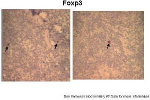 ﻿Sample Type: Mouse Spleen frozen with positive lymphocytes/ HPF (x400)Primary Dilution: 1:100Secondary Antibody: Vector Lab Goat Biotin-Conjugated Anti-Rabbit IgGSecondary Dilution: 1:100Image Submitted By: Atsushi Kawabata at Kansas State University (FOXP3 抗体  (N-Term))