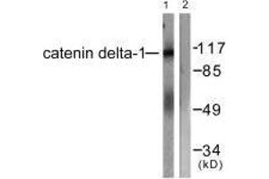 Western blot analysis of extracts from HuvEc cells, using Catenin-δ1 (Ab-228) antibody. (CTNND1 抗体  (Tyr228))