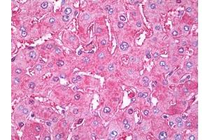 Image no. 1 for anti-Transferrin (TF) antibody (ABIN471288) (Transferrin 抗体)