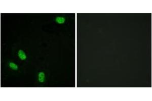 Immunofluorescence analysis of HeLa cells, using Progesterone Receptor (Phospho-Ser294) Antibody. (Progesterone Receptor 抗体  (pSer294))