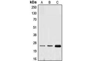 Western blot analysis of Ephrin A1 expression in THP1 (A), HUVEC (B), MCF7 (C) whole cell lysates. (Ephrin A1 抗体  (Center))