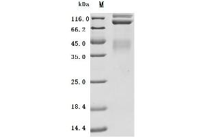 (Tris-Glycine gel) Discontinuous SDS-PAGE (reduced) with 5 % enrichment gel and 15 % separation gel.