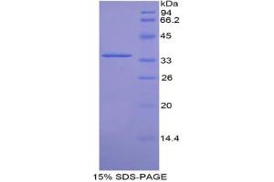 SDS-PAGE analysis of Mouse CDK4 Protein. (CDK4 蛋白)