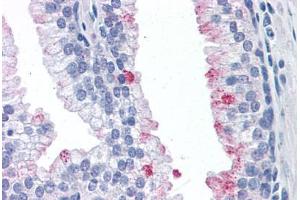 Human Prostate: Formalin-Fixed, Paraffin-Embedded (FFPE) (Rhotekin 抗体  (AA 451-550))