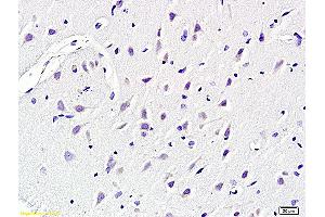 Immunohistochemistry (IHC) image for anti-Potassium Intermediate/small Conductance Calcium-Activated Channel, Subfamily N, Member 4 (KCNN4) (AA 325-427) antibody (ABIN719786)
