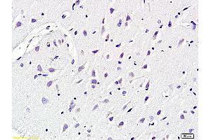 Formalin-fixed and paraffin embedded rat brain labeled with Anti KCNN4 Polyclonal Antibody, Unconjugated (ABIN719786) at 1:200 followed by conjugation to the secondary antibody and DAB staining (KCNN4 抗体  (AA 325-427))