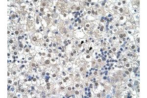 RTN2 antibody was used for immunohistochemistry at a concentration of 4-8 ug/ml to stain Hepatocytes (arrows) in Human Liver. (Reticulon 2 抗体  (N-Term))