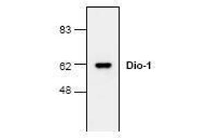 Image no. 1 for anti-Death Inducer-Obliterator 1 (DIDO1) (N-Term) antibody (ABIN127222) (DIDO1 抗体  (N-Term))