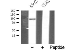Western blot analysis of VAV1 expression in K562 whole cell lysates,The lane on the left is treated with the antigen-specific peptide. (VAV1 抗体  (N-Term))
