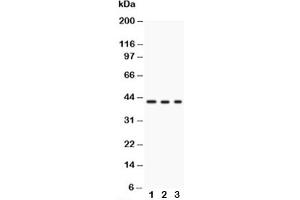 Western blot testing of GAP43 antibody and Lane 1:  U87 (GAP43 抗体)