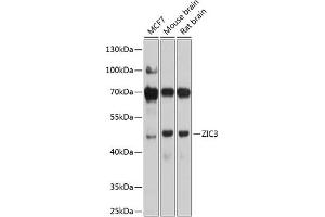 Western blot analysis of extracts of various cell lines, using ZIC3 antibody (ABIN6133228, ABIN6150444, ABIN6150446 and ABIN6225011) at 1:1000 dilution. (ZIC3 抗体  (AA 1-240))
