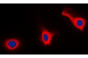 Immunofluorescent analysis of CD9 staining in HEK293T cells. (CD9 抗体  (Center))