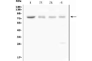 Western blot analysis of ABCG8 using anti-ABCG8 antibody (ABIN7601918).