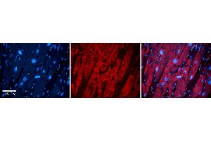 Rabbit Anti-ZYX Antibody   Formalin Fixed Paraffin Embedded Tissue: Human heart Tissue Observed Staining: Cytoplasmic in mitochondria Primary Antibody Concentration: N/A Other Working Concentrations: 1:600 Secondary Antibody: Donkey anti-Rabbit-Cy3 Secondary Antibody Concentration: 1:200 Magnification: 20X Exposure Time: 0. (ZYX 抗体  (Middle Region))