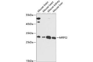 Western blot analysis of extracts of various cell lines, using MRPS2 antibody (ABIN7268584) at 1:3000 dilution. (MRPS2 抗体  (AA 1-296))