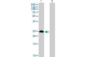 Western Blot analysis of ZNF486 expression in transfected 293T cell line by ZNF486 MaxPab polyclonal antibody. (ZNF486 抗体  (AA 1-216))