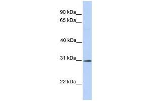 WB Suggested Anti-RNF148 Antibody Titration:  0. (RNF148 抗体  (C-Term))