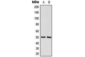 Western Blotting (WB) image for anti-Cleavage Stimulation Factor, 3' Pre-RNA, Subunit 1, 50kDa (CSTF1) (N-Term) antibody (ABIN7299198)