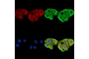 ABIN7095364 and ABIN7099421 staining Hela cells by IF/ICC. (WDR76 抗体)