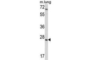 Western blot analysis of IGFBP4 Antibody (N-term) in mouse lung tissue lysates (35ug/lane). (IGFBP4 抗体  (N-Term))