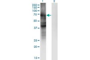 Western Blotting (WB) image for anti-Solute Carrier Family 4, Sodium Bicarbonate Cotransporter, Member 4 (SLC4A4) (AA 1-646) antibody (ABIN563745)