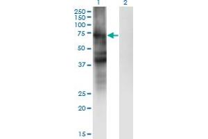 Western Blot analysis of SLC4A4 expression in transfected 293T cell line by SLC4A4 monoclonal antibody (M01), clone 1G2. (SLC4A4 抗体  (AA 1-646))