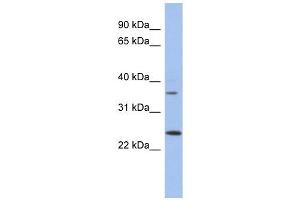 WBP2NL antibody used at 1 ug/ml to detect target protein. (WBP2NL 抗体  (N-Term))