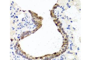 Immunohistochemistry of paraffin-embedded Rat lung using TOPBP1 Polyclonal Antibody at dilution of 1:100 (40x lens). (TOPBP1 抗体)